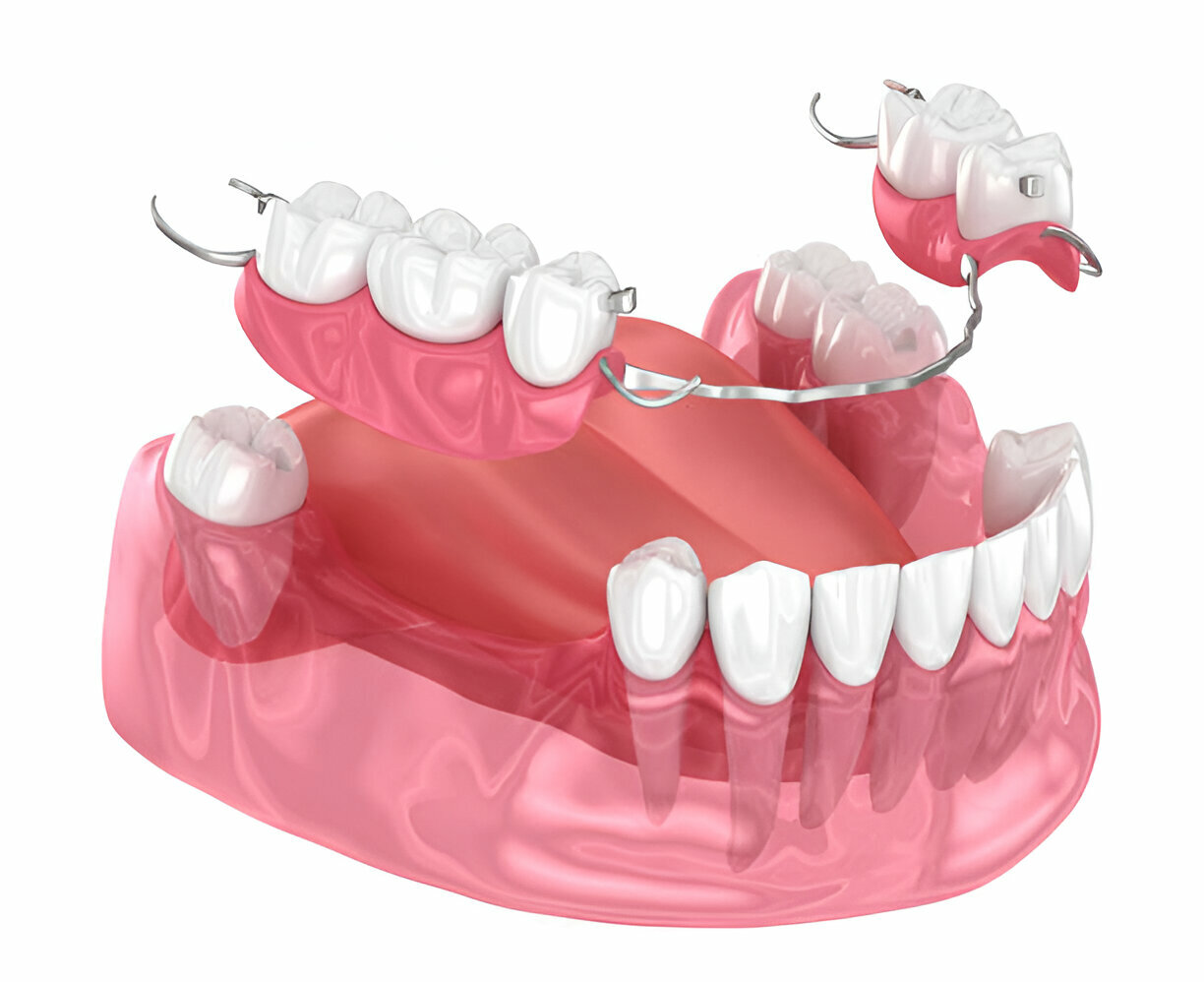 How to Maintain Good Oral Hygiene with Dentures_2