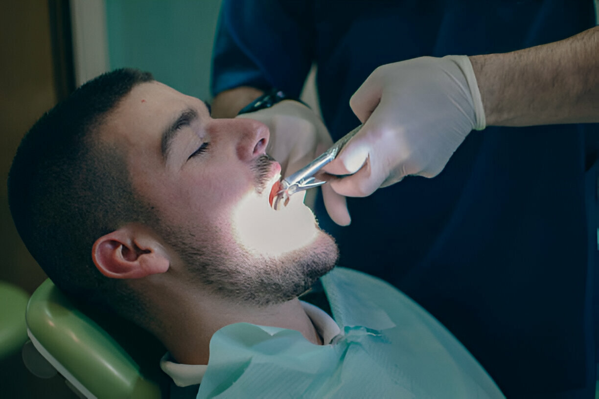 What to Expect During a Tooth Extraction at the Dental Care Center of South Kansas City_1